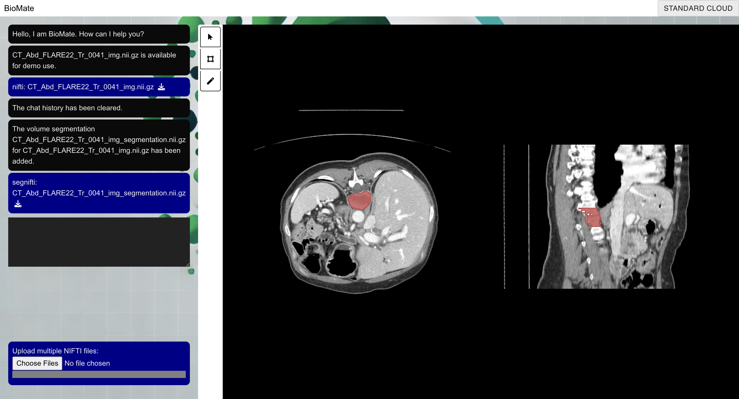 MedSAM2